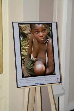 			Image photo gallery  - opening of the photographic exhibition Public Health Begins with Breastfeeding (2012)
	